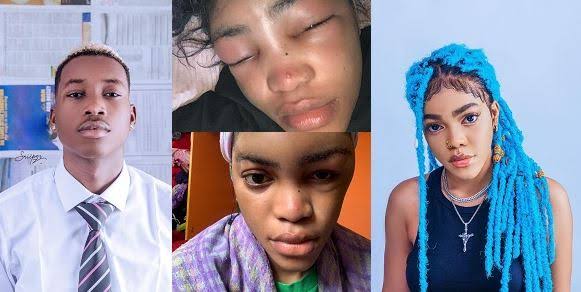 Singer Lil Frosh Arrested for Beating Up Girlfriend, Gift Camille